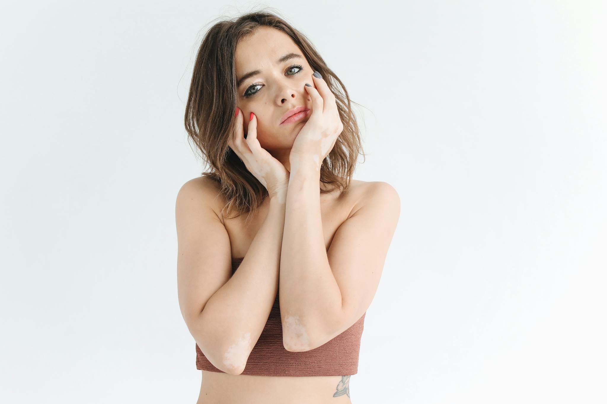 Confident woman with vitiligo posing on white background, embracing beauty and self-expression.